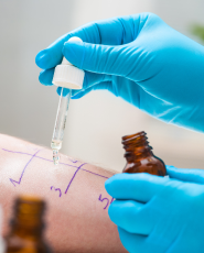 Needle-free allergy tests being applied to a patient’s skin